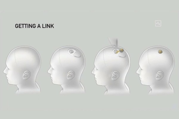 À la loupe 🔎 #4 Transhumanisme : des pistes plausibles pour augmenter notre productivité ?